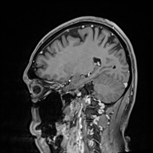 Click on the Serie image to view the images of VILLANUEVA, WILLIAM A.